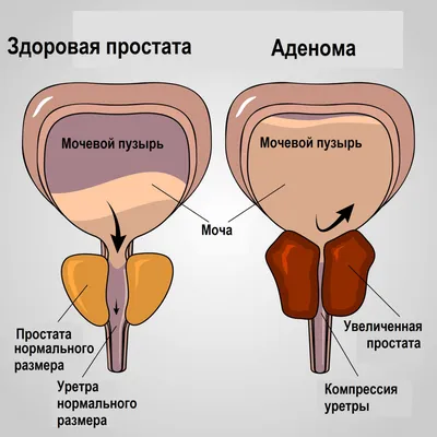 Как разогнать ЛИМФУ? САМЫЕ действенные способы!