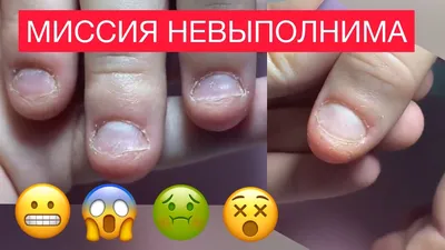 САМЫЕ ОБКУСАННЫЕ 😱 КОРОТКИЕ НОГТИ ГРЫЗУНА 🤔 КАК СДЕЛАТЬ Наращивание  миндаль💅 - YouTube