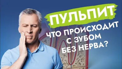 Зачем удаляют нерв из зуба при пульпите? | Студия Улыбки