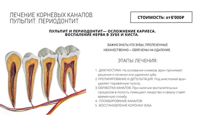 Лечение зубов - Реадовская стоматология