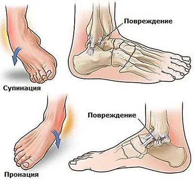 Анатомия стопы. Интересная подача анатомии