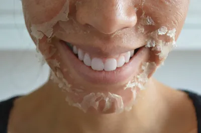 Как ухаживать за кожей лица после пилинга? | Статьи GiGi.ru