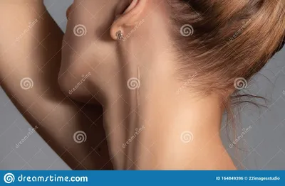 Женщина со шрамом на шее, закрывается Стоковое Фото - изображение  насчитывающей ñ…ð¸ñ€ñƒñ€ð³ð¸ñ , ñ ðº: 164849396