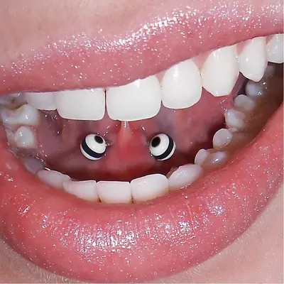 Мини-гайд: Виды пирсинга полости рта