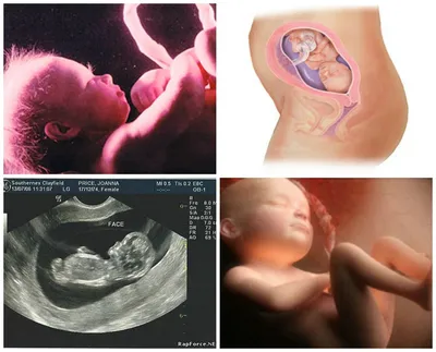 17-я неделя беременности, вес ребенка, фото, календарь беремености |  Мамоведия - о здоровье и развитии ребенка