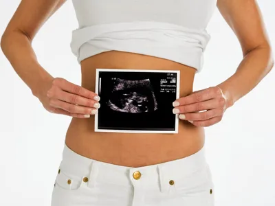 Эмбрион» не равно «человек». Почему аборт нельзя приравнивать к убийству -  Горящая изба