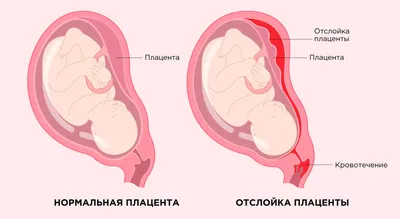 7 неделя беременности: что происходит с малышом и мамой