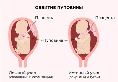 Неделя 31. Глаза вашего малыша - Иркутский городской перинатальный центр