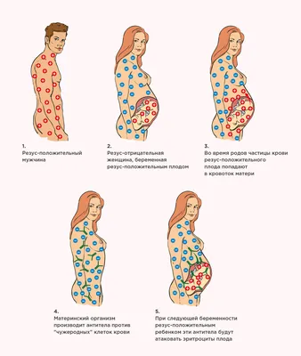 Мальчик или девочка? Как определить пол ребенка во время беременности
