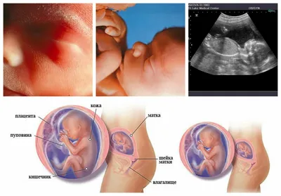Развитие плода по неделям, описание и самочувствие | Развивайка | Дзен