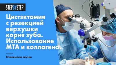 Endodontic Microsurgery. Цист-эктомия с резекцией вершушки корня 11 зуба.