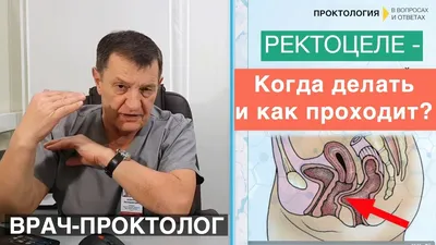 Операция ректоцеле - как проходит? Безумно страшно! - YouTube