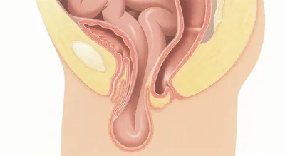 Операция при ректоцеле в Москве: цена лечения ректоцеле в клинике,  записаться, врачи, отзывы пациентов | Юсуповская больница