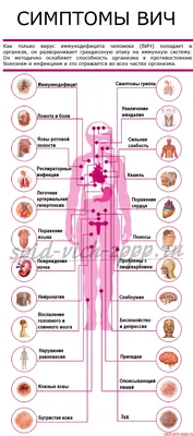 ᐉ Симптомы ВИЧ-инфекции, СПИДа (иллюстрированная схема+фото+ видео)