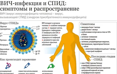 Важно знать: симптомы ВИЧ/СПИД - 18.02.2020, Sputnik Беларусь