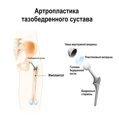 Клиническая диагностика болезней суставов читать онлайн или скачать  бесплатно