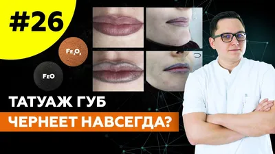 Причины почернения губ после удаления перманентного макияжа -  Владмедицина.ру