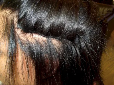 Последствия наращивания волос (37 лучших фото)