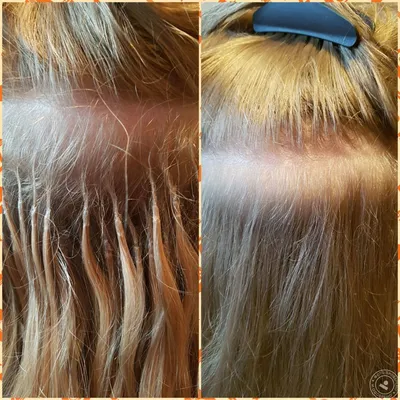 Волосы после снятия наращивания - 71 фото