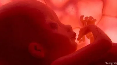 Осложнения при беременности после медикаментозного аборта - Телеграф