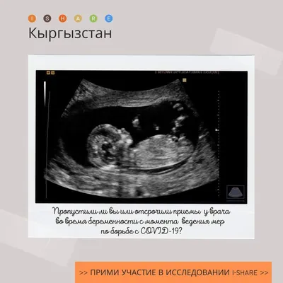 Smankulova Nurgul on Twitter: \"Рост материнской смертности также произошёл  за счет случаев КОВИД-19 в 2020 году, по данным МЗ. Повлияло ли присутствие  КОВИДа-19 на Ваше поведение, образ жизни и доступ к услугам