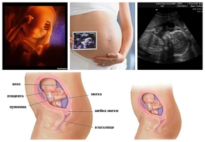 22 неделя беременности - все о беременности на 22 неделе - Телеграф