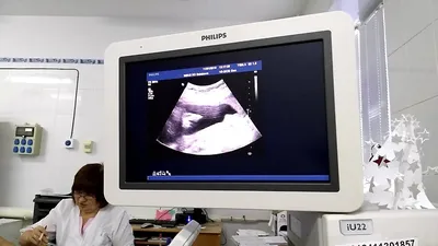 3D узи 22 недели беременности, мальчик. - YouTube