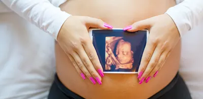 🤰 5. Пятая неделя беременности. Первый триместр - Калькулятор и календарь  беременности