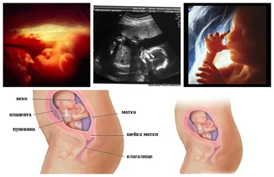20-я неделя беременности - Телеграф