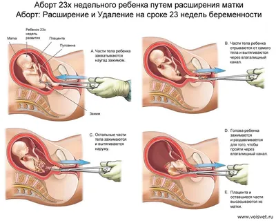 Как сделать УЗИ на 3-5 неделе беременности