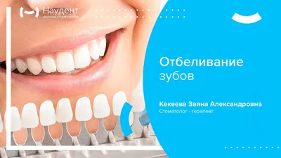 Косметическое отбеливание зубов в стоматологии на Ходынке