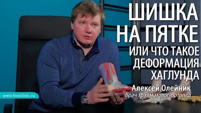 A BUMP ON THE LEG ABOVE THE HEEL or what is the Haglund deformation Aleksey  Oleynik #footclinic - YouTube