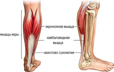 Боли в области икры: дифференциальный диагноз