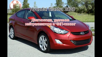 Диагностика, удаление нейтрализатора и ЧИП тюнинг Hyundai Elantra 2020.  Бесполезность обманок! - YouTube