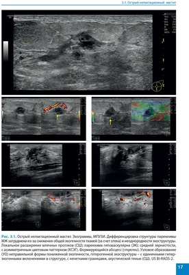 Книга \" Ультразвуковое исследование молочных желез\". Атлас - Сенча А. Н.  Купить книгу