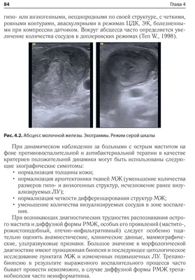 Книга \"Ультразвуковое мультипараметрическое исследование молочных желез\" -  Сенча А. Н.