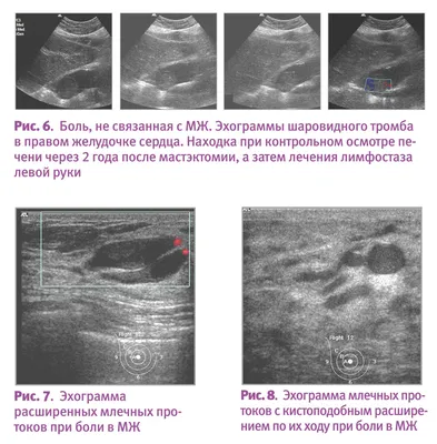 Ультразвуковое исследование - Специальные темы - Справочник MSD  Профессиональная версия