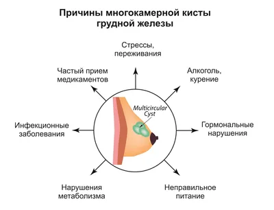 Ультразвуковой сканер Sonoscape S40Exp