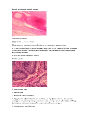 Михайлова Анастасия Борисовна Клиникоморфологическое обоснован