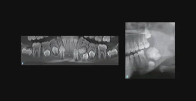 USMF “N. Testemiţanu” Catedra chirurgie orală şi maxilo-facială