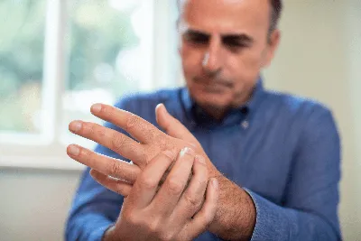 Как лечить узелки Бушара и Гебердена — наросты на суставах пальцев рук —  Homviora