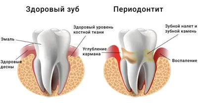 Атравматичное удаление зачатков «восьмых» зубов :: NORD DENTAL — семейная  стоматология. Две клиники на севере Петербурга