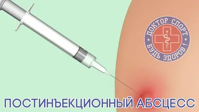 В Смоленской области ребенка прооперировали после прививки в саду |  glavnayatema.com