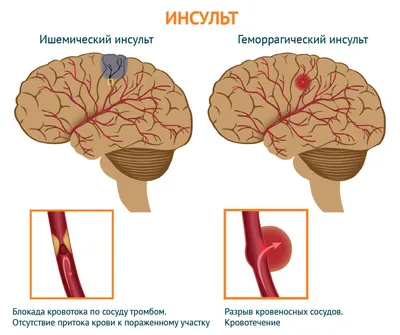 КТ головного мозга в Киеве — цена 900 грн в СДС на КТ головы