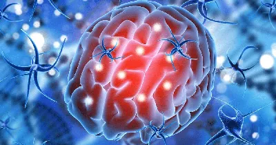 Герминома головного мозга - признаки, причины, симптомы, лечение и  профилактика - iDoctor.kz