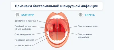 Соляная пещера Бишкек - 📌Фарингит - это воспаление глотки и лимфоидной  ткани. Проявляется першением и сухостью в горле, сухим кашлем, болью при  глотании. При этом заболевании часто повышается температура и появляется  белый