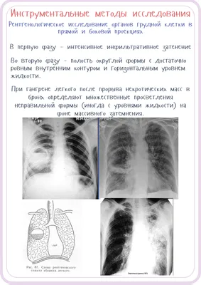 Гнойные заболевания лёгких | Портал радиологов