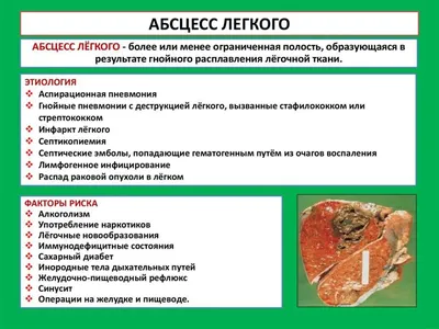 МЕТОДИЧЕСКИЕ РЕКОМЕНДАЦИИ Тема: Гнойные заболевания легких Цель : зак