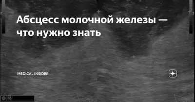 Клинический протокол ABM №30: Образования молочных желез, жалобы, связанные  с молочными железами, и диагностика патологий молочной железы у кормящей  женщины