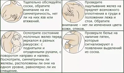 Заболевания молочной железы - презентация онлайн